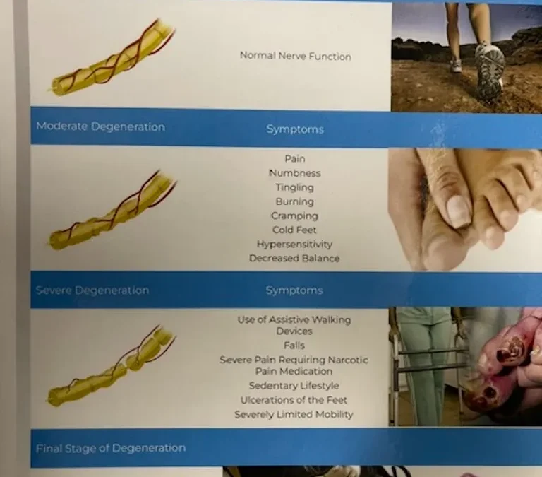 Neuropathy In Tulsa OK