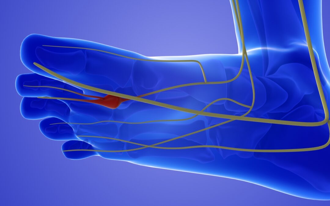 Tulsa Neuropathy Clinic