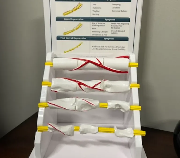 Tulsa OK Neuropathy
