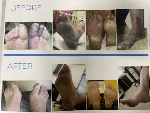 Neuropathy-Clinic-Tulsa-OK-13
